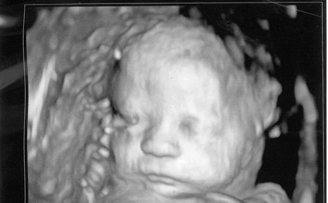 Pennsylvania House Passes Amendment for Abortions Up to Birth