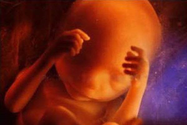 President Trump Ends All Tax-Funded Research With Aborted Baby Parts