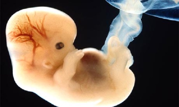 65 Million Babies Have Been Killed in Abortions Since Roe, We Must End Abortion