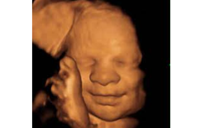 642,700 Babies Were Killed With Abortion Pills in 2023. We Have to Stop This