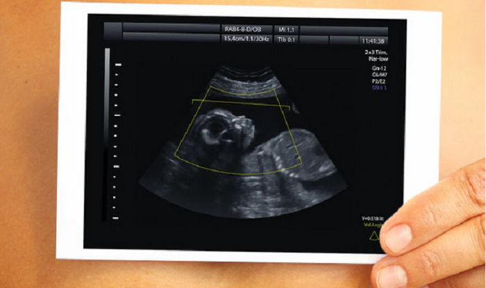 Mississippi House Passes Bill to Stop Abortions