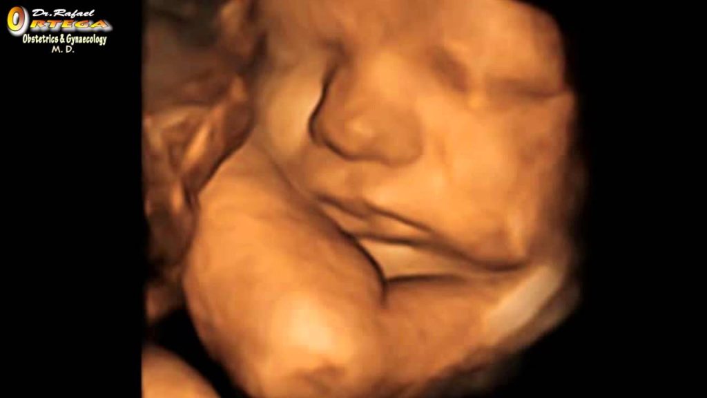 “Pro-Choice” is Still a Horrible Euphemism for Killing Babies in Abortions