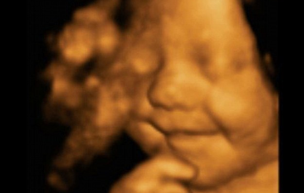 We Have to Stop Abortions Up to Birth in Virginia