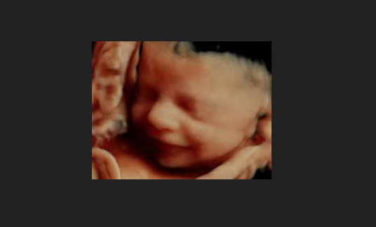 Abortions Double in Massachusetts as 25,000 More Babies Killed