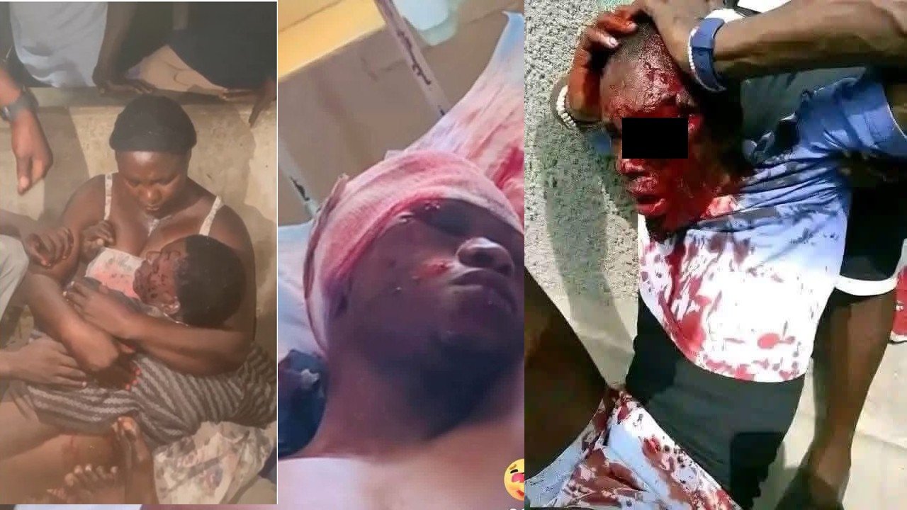 Graphic images depicting individuals with severe injuries and bleeding, highlighting the urgent need for medical assistance and emergency response.