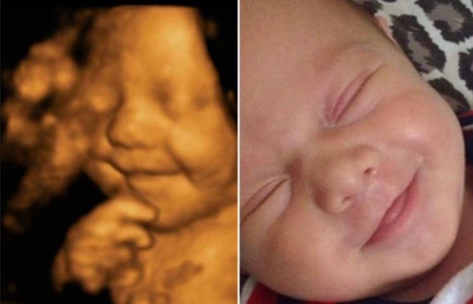Senate Will Investigate Dangerous Abortion Pills Killing Babies and Hurting Women