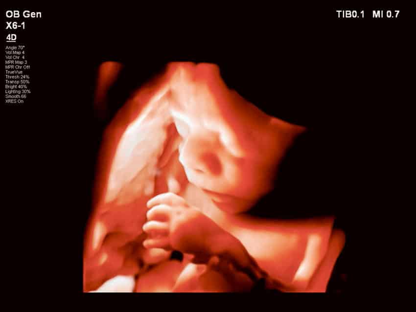 Pennsylvania Court Forces Taxpayers to Fund Abortions