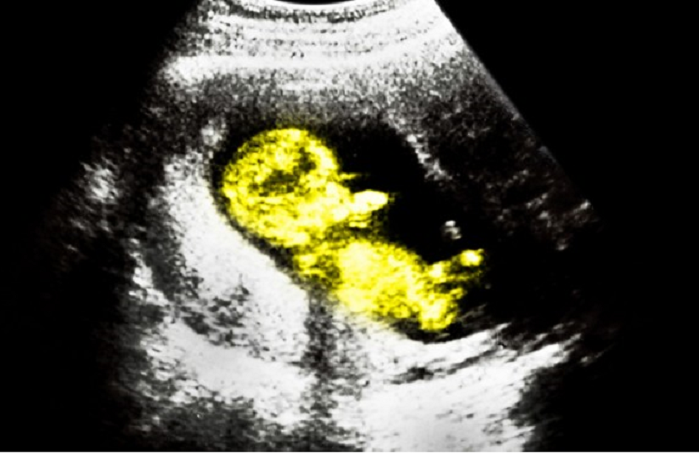 Pro-Life Group Supports Louisiana’s Bid to Stop Mail-Order Abortions