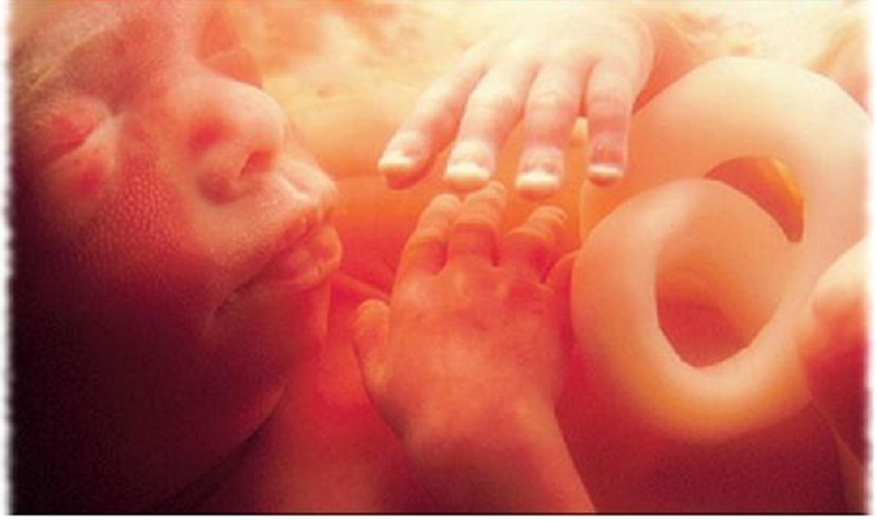Missouri Pro-Life Group Fights for Amendment 3 to Protect Babies From Abortion