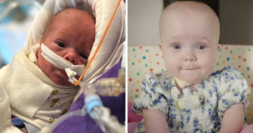 26-Week-Premature Baby Heads Home From the Hospital
