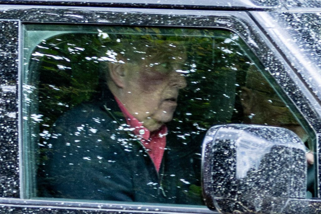 Shocking Photos Show Prince Andrew With Massive Facial Bruise