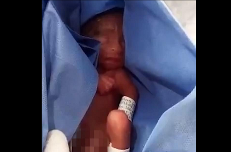 Five Month Old Baby Survived Abortion, Then Had Her Organs Harvested