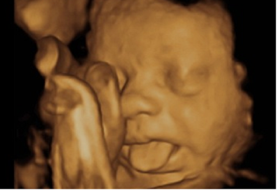 No Matter What They Call It, Abortion Kills Babies