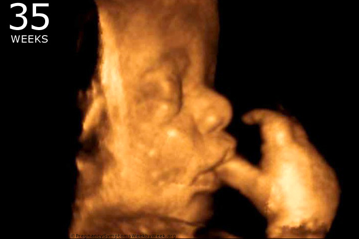 Republican Senators Fight to Stop Abortion Pills
