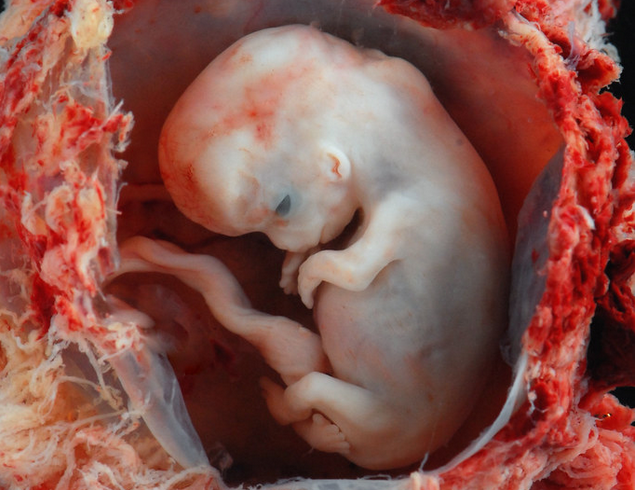 Unregulated IVF Destroys More Babies Annually Than Abortion Industry