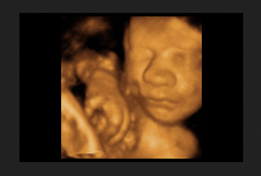 Pro-Life States Get to Move Forward With Case Against Mail-Order Abortions