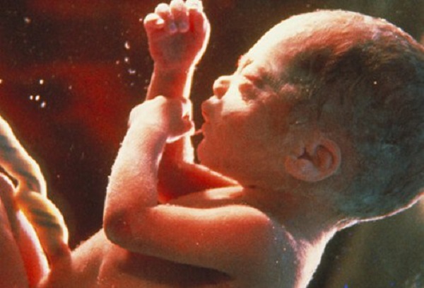 India Court Won’t Approve Killing 32-Week-Old Baby in Abortion