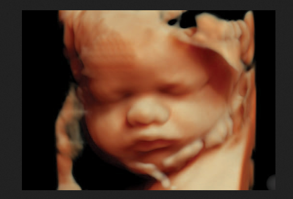 Democrats Will Pass Right to Kill Babies in Abortions if They Capture Congress