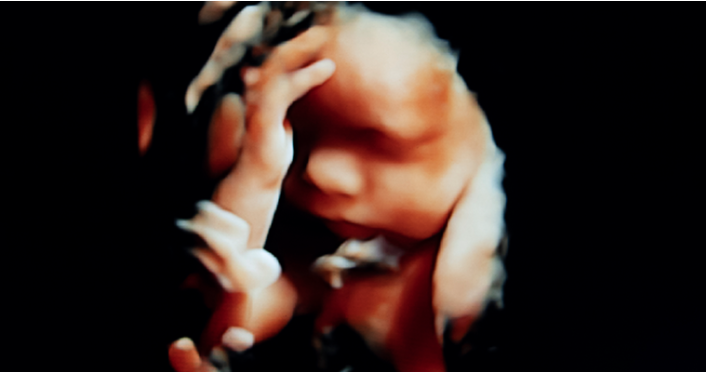 Missouri Abortion Activists Raise $26 Million to Fight Pro-Life Amendment 3